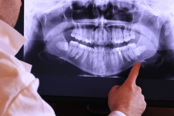 Best Emergency Wisdom Teeth Removal in Willcox, AZ